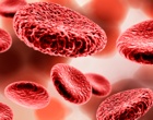 Schematische Darstellung einer Sepsis im Blutbild